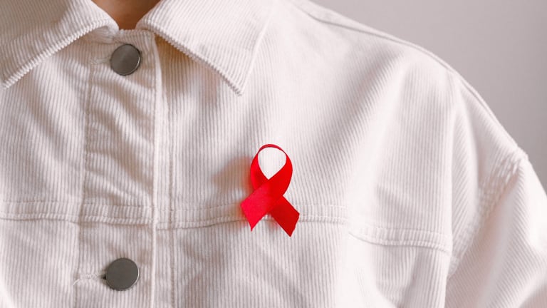 IMG Helps & Artist ESPO Have a Message for World AIDS Day